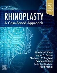 Produktbild: Rhinoplasty