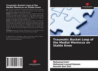 Produktbild: Traumatic Bucket Loop of the Medial Meniscus on Stable Knee