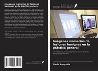 Produktbild: Im&aacute;genes mamarias de lesiones benignas en la pr&aacute;ctica general