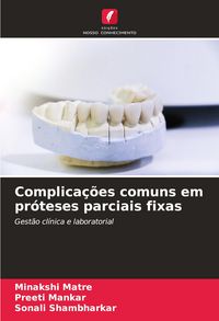 Produktbild: Complica&ccedil;&otilde;es comuns em pr&oacute;teses parciais fixas