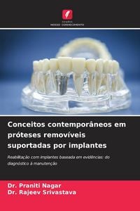 Produktbild: Conceitos contempor&acirc;neos em pr&oacute;teses remov&iacute;veis suportadas por implantes