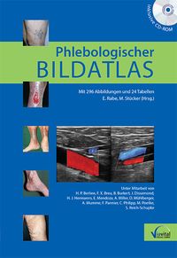 Produktbild: Phlebologischer Bildatlas
