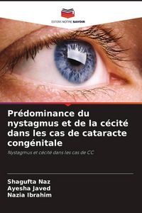 Produktbild: Pr&eacute;dominance du nystagmus et de la c&eacute;cit&eacute; dans les cas de cataracte cong&eacute;nitale