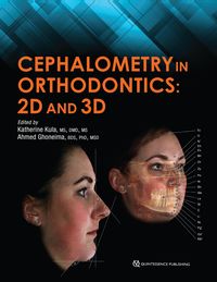 Bild vom Artikel Cephalometry in Orthodontics vom Autor Katherine Kula