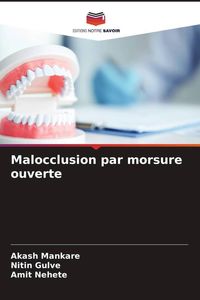 Produktbild: Malocclusion par morsure ouverte