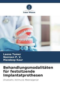 Produktbild: Behandlungsmodalit&auml;ten f&uuml;r festsitzende Implantatprothesen