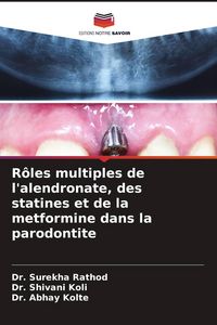 Produktbild: R&ocirc;les multiples de l'alendronate, des statines et de la metformine dans la parodontite
