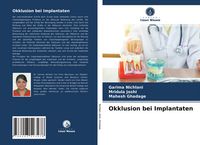 Produktbild: Okklusion bei Implantaten
