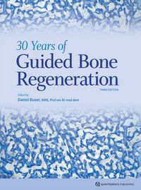 Produktbild: 30 Years of Guided Bone Regeneration