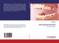 Produktbild: Self Ligating Brackets
