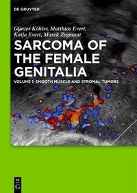 Produktbild: Smooth muscle and stromal tumors and prevention of inadequate surgery