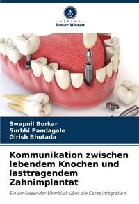 Produktbild: Kommunikation zwischen lebendem Knochen und lasttragendem Zahnimplantat
