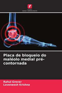 Produktbild: Placa de bloqueio do mal&eacute;olo medial pr&eacute;-contornada