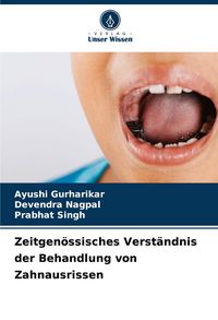 Produktbild: Zeitgen&ouml;ssisches Verst&auml;ndnis der Behandlung von Zahnausrissen