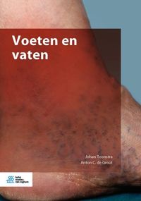 Produktbild: Voeten en vaten