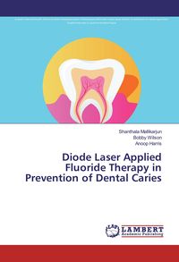 Produktbild: Diode Laser Applied Fluoride Therapy in Prevention of Dental Caries
