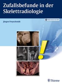 Produktbild: Zufallsbefunde in der Skelettradiologie