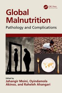 Produktbild: Global Malnutrition