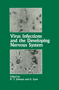 Produktbild: Virus Infections and the Developing Nervous System