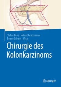 Produktbild: Chirurgie des Kolonkarzinoms
