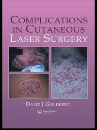 Produktbild: Complications in Laser Cutaneous Surgery