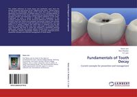 Produktbild: Fundamentals of Tooth Decay
