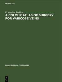 Produktbild: A Colour Atlas of Surgery for Varicose Veins