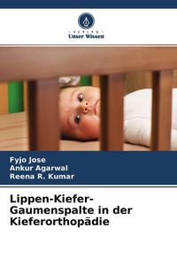 Produktbild: Lippen-Kiefer-Gaumenspalte in der Kieferorthop&auml;die