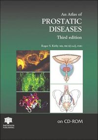 Produktbild: Atlas of Prostatic Diseases Cd-Rom