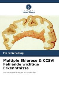 Produktbild: Multiple Sklerose & CCSVI Fehlende wichtige Erkenntnisse