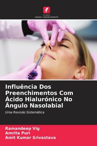 Produktbild: Influ&ecirc;ncia Dos Preenchimentos Com &Aacute;cido Hialur&oacute;nico No &Acirc;ngulo Nasolabial