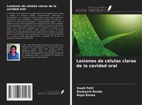 Produktbild: Lesiones de c&eacute;lulas claras de la cavidad oral