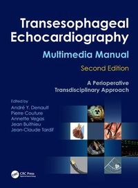 Produktbild: Transesophageal Echocardiography Multimedia Manual