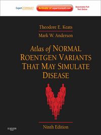 Produktbild: Atlas of Normal Roentgen Variants That May Simulate Disease E-Book