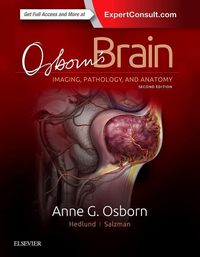 Produktbild: Osborn, A: Osborn's Brain