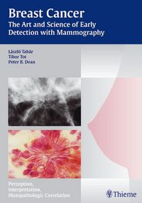 Produktbild: Breast Cancer - The Art and Science of Early Detection with Mammography