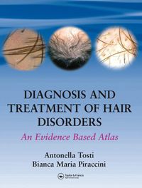 Produktbild: Diagnosis and Treatment of Hair Disorders