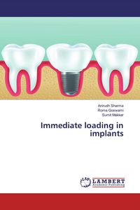 Produktbild: Immediate loading in implants