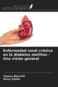 Produktbild: Enfermedad renal cr&oacute;nica en la diabetes mellitus - Una visi&oacute;n general