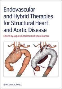 Produktbild: Endovascular and Hybrid Therapies for Structural Heart and Aortic Disease