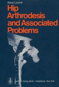 Produktbild: Hip Arthrodesis and Associated Problems