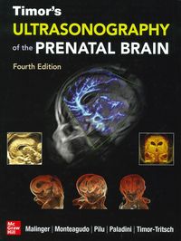 Produktbild: Timor's Ultrasonography of the Prenatal Brain, Fourth Edition