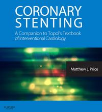Produktbild: Coronary Stenting: A Companion to Topol's Textbook of Interventional Cardiology E-Book