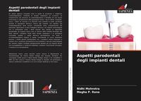 Produktbild: Aspetti parodontali degli impianti dentali