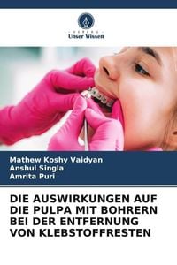 Produktbild: Die Auswirkungen Auf die Pulpa mit Bohrern bei der Entfernung von Klebstoffresten