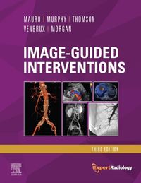 Produktbild: Image-Guided Interventions E-Book