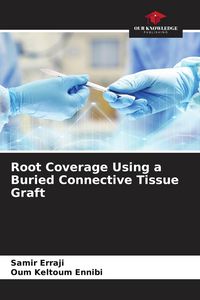 Produktbild: Root Coverage Using a Buried Connective Tissue Graft
