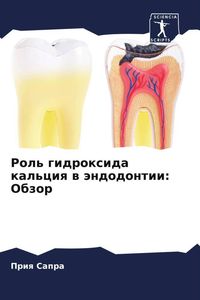 Produktbild: Rol' gidroxida kal'ciq w &auml;ndodontii: Obzor