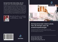 Produktbild: Extrapulmonale tuberculose. Van de kliniek naar de anatomopathologie