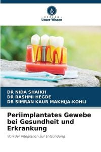 Produktbild: Periimplantates Gewebe bei Gesundheit und Erkrankung